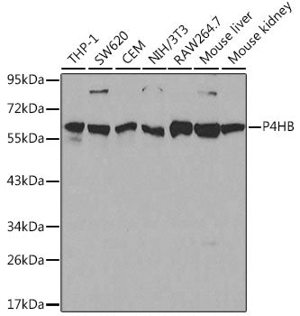 WesternBlot (WB) analysis of P4HB polyclonal antibody