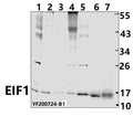 Western blot (WB) analysis of EIF1 pAb at 1:500 dilution
Lane1:A549 whole cell lysate(40ug)
Lane2:Raw264.7 whole cell lysate(40ug)
Lane3:U-87MG whole cell lysate(40ug)
Lane4:THP-1 whole cell lysate(40ug)
Lane5:PC3 whole cell lysate (40ug)
Lane6:The lung tissue lysate of Rat (40ug)
Lane7:The spleen tissue lysate of Mouse(40ug)