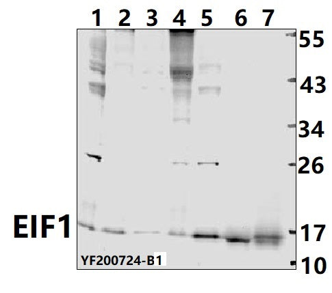Western blot (WB) analysis of EIF1 pAb at 1:500 dilution
Lane1:A549 whole cell lysate(40ug)
Lane2:Raw264.7 whole cell lysate(40ug)
Lane3:U-87MG whole cell lysate(40ug)
Lane4:THP-1 whole cell lysate(40ug)
Lane5:PC3 whole cell lysate (40ug)
Lane6:The lung tissue lysate of Rat (40ug)
Lane7:The spleen tissue lysate of Mouse(40ug)