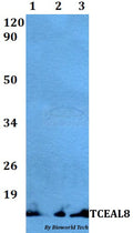 Western blot (WB) analysis of TCEAL8 polyclonal antibody at 1:500 dilution
Lane1:Hela whole cell lysate
Lane2:Raw264.7 whole cell lysate 
Lane3:PC12 whole cell lysate