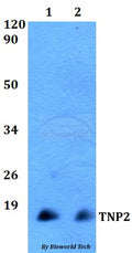 TNP2 polyclonal antibody – Figure 1 of 1