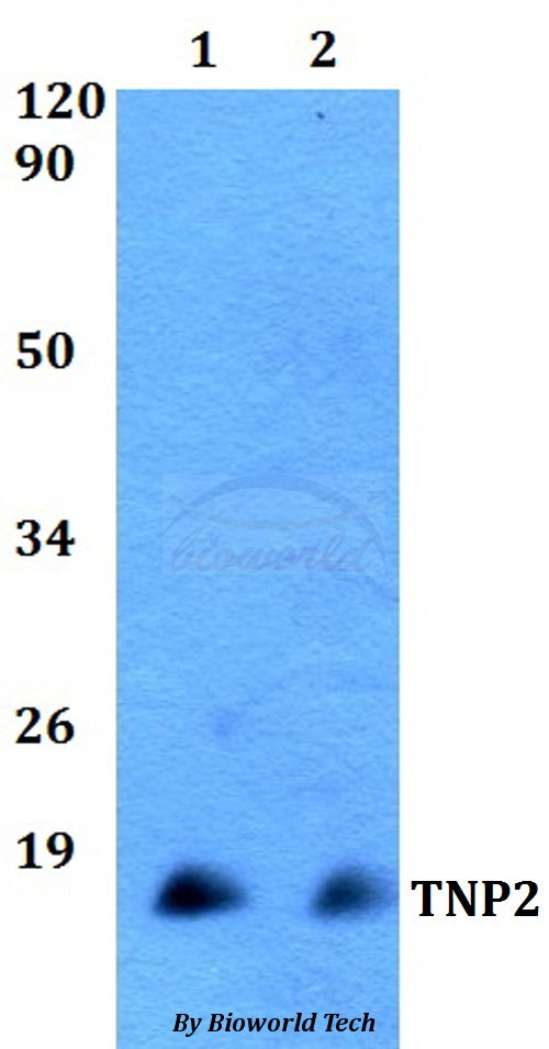 TNP2 polyclonal antibody – Figure 1 of 1