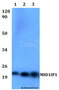 Western blot (WB) analysis of MID1IP1 polyclonal antibody at 1:500 dilution
Lane1:HEK293Twhole cell lysate
Lane2:Raw264.7 whole cell lysate 
Lane3:PC12 whole cell lysate