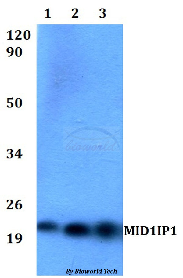 Western blot (WB) analysis of MID1IP1 polyclonal antibody at 1:500 dilution
Lane1:HEK293Twhole cell lysate
Lane2:Raw264.7 whole cell lysate 
Lane3:PC12 whole cell lysate
