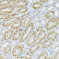 WesternBlot (WB) analysis of PIK3CA polyclonal antibody.