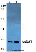 Western blot (WB) analysis of AANAT polyclonal antibody at 1:500 dilution
Lane1:A549 whole cell lysate
Lane2:PC12 whole cell lysate