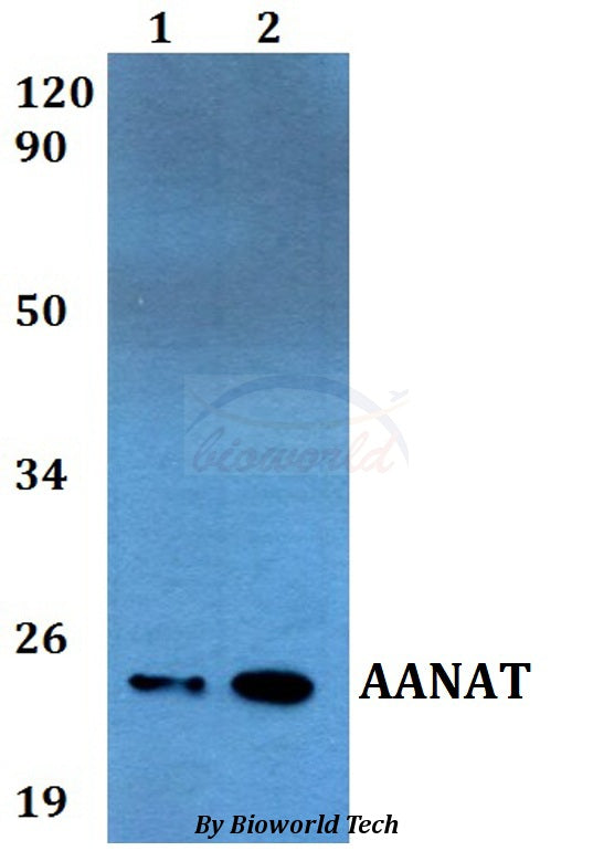 Western blot (WB) analysis of AANAT polyclonal antibody at 1:500 dilution
Lane1:A549 whole cell lysate
Lane2:PC12 whole cell lysate