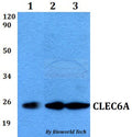 Western blot (WB) analysis of CLEC6A polyclonal antibody at 1:500 dilution
Lane1:MCF-7 whole cell lysate
Lane2:sp2/0 whole cell lysate 
Lane3:PC12 whole cell lysate