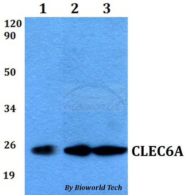 Western blot (WB) analysis of CLEC6A polyclonal antibody at 1:500 dilution
Lane1:MCF-7 whole cell lysate
Lane2:sp2/0 whole cell lysate 
Lane3:PC12 whole cell lysate