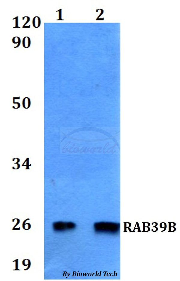 Western blot (WB) analysis of RAB39B polyclonal antibody at 1:500 dilution
Lane1:MCF-7 whole cell lysate
Lane2:H9C2 whole cell lysate