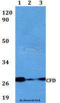 Western blot (WB) analysis of CFD polyclonal antibody at 1:500 dilution
Lane1:A549 whole cell lysate
Lane2:sp2/0 whole cell lysate 
Lane3:PC12 whole cell lysate
