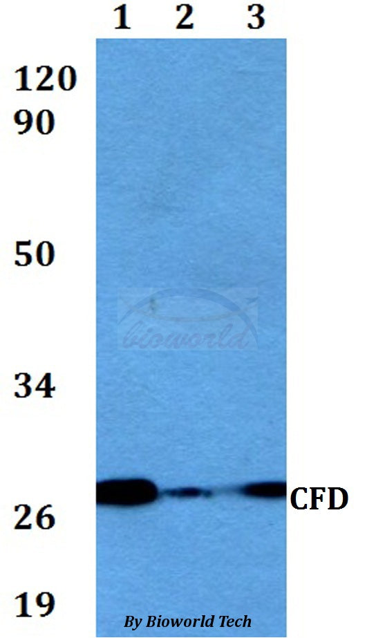 Western blot (WB) analysis of CFD polyclonal antibody at 1:500 dilution
Lane1:A549 whole cell lysate
Lane2:sp2/0 whole cell lysate 
Lane3:PC12 whole cell lysate