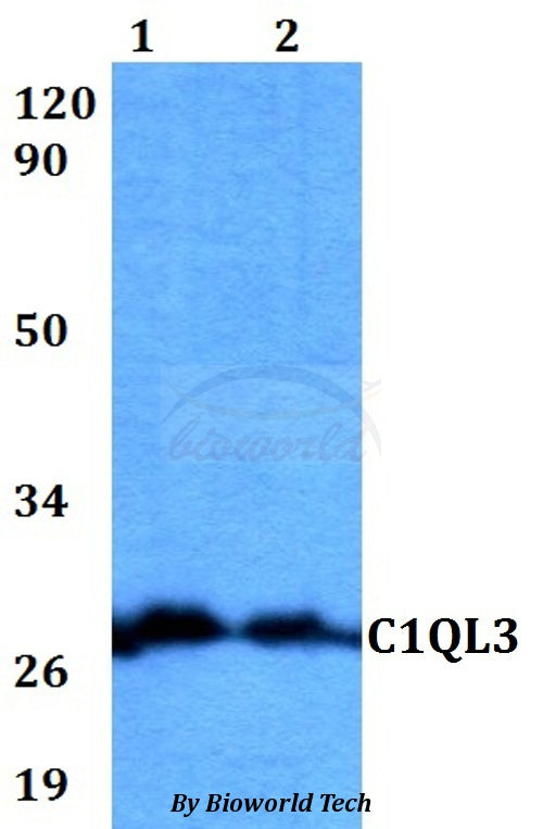 Western blot (WB) analysis of C1QL3 polyclonal antibody at 1:500 dilution
Lane1:HEK293T whole cell lysate
Lane2:Raw264.7 whole cell lysate
