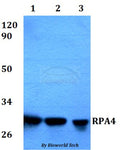 Western blot (WB) analysis of RPA4 polyclonal antibody at 1:500 dilution
Lane1:HEK293T whole cell lysate
Lane2:Raw264.7 whole cell lysate 
Lane3:PC12 whole cell lysate