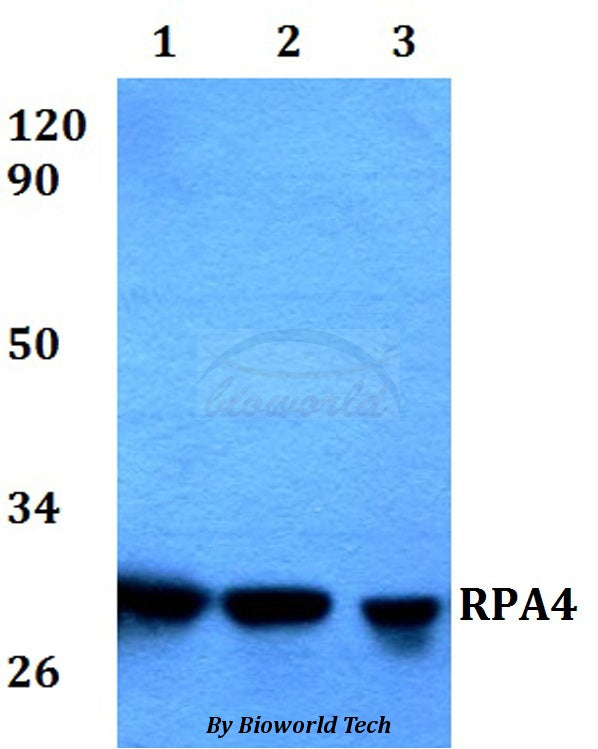 Western blot (WB) analysis of RPA4 polyclonal antibody at 1:500 dilution
Lane1:HEK293T whole cell lysate
Lane2:Raw264.7 whole cell lysate 
Lane3:PC12 whole cell lysate