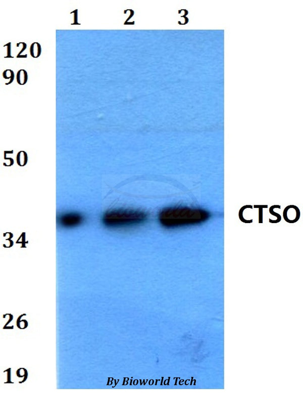 Western blot (WB) analysis of CTSO polyclonal antibody at 1:500 dilution
Lane1:HEK293T whole cell lysate
Lane2:Raw264.7 whole cell lysate 
Lane3:H9C2 whole cell lysate