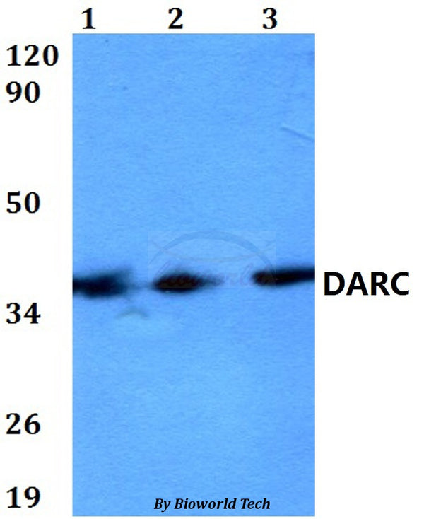 Western blot (WB) analysis of DARC polyclonal antibody at 1:500 dilution
Lane1:HEK293T whole cell lysate
Lane2:Raw264.7 whole cell lysate 
Lane3:PC12 whole cell lysate