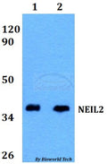 Western blot (WB) analysis of NEIL2 polyclonal antibody at 1:500 dilution
Lane1:HEK293T whole cell lysate
Lane2:PC12 whole cell lysate