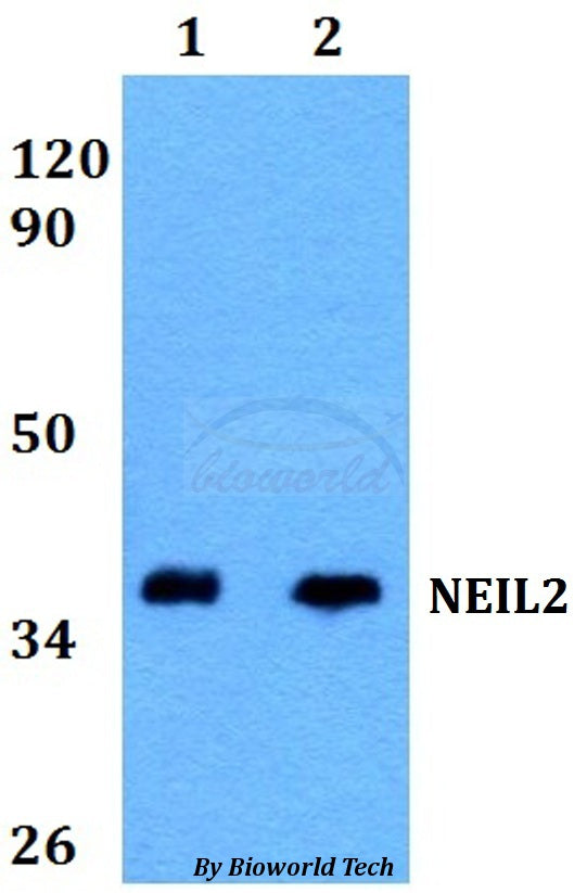 Western blot (WB) analysis of NEIL2 polyclonal antibody at 1:500 dilution
Lane1:HEK293T whole cell lysate
Lane2:PC12 whole cell lysate
