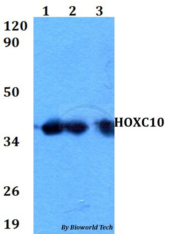 Western blot (WB) analysis of HOXC10 polyclonal antibody at 1:500 dilution
Lane1:HEK293T whole cell lysate
Lane2:sp2/0 whole cell lysate 
Lane3:H9C2 whole cell lysate