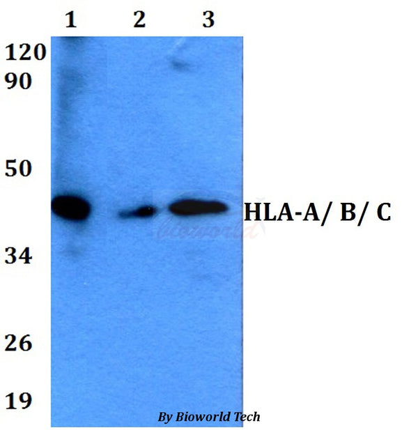 HLA-A/ B/ C polyclonal antibody – Figure 1 of 1