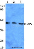 MESP2 polyclonal antibody – Figure 1 of 1