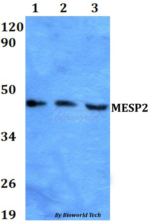 MESP2 polyclonal antibody – Figure 1 of 1