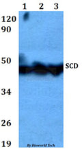 SCD polyclonal antibody – Figure 1 of 1