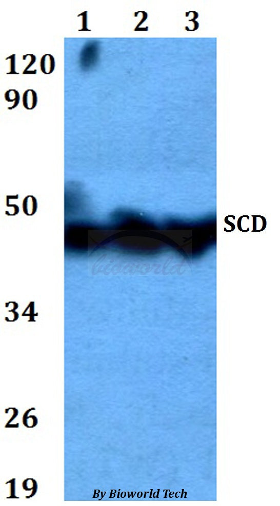 SCD polyclonal antibody – Figure 1 of 1
