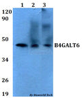 B4GALT6 polyclonal antibody – Figure 1 of 1
