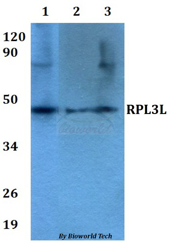 RPL3L polyclonal antibody – Figure 1 of 1