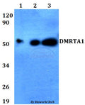 Western blot (WB) analysis of DMRTA1 polyclonal antibody at 1:500 dilution
Lane1:HEK293T whole cell lysate
Lane2:Raw264.7 whole cell lysate 
Lane3:PC12 whole cell lysate