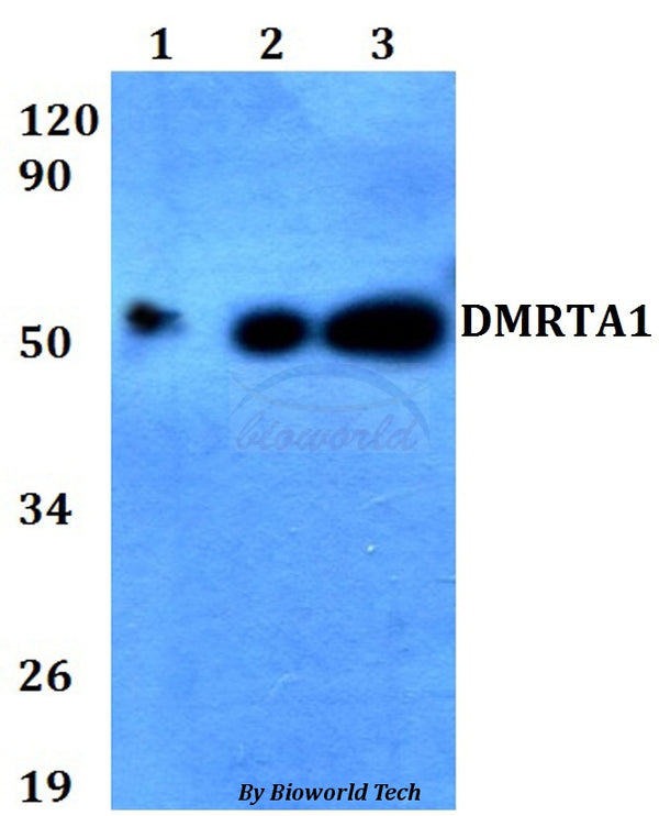 Western blot (WB) analysis of DMRTA1 polyclonal antibody at 1:500 dilution
Lane1:HEK293T whole cell lysate
Lane2:Raw264.7 whole cell lysate 
Lane3:PC12 whole cell lysate