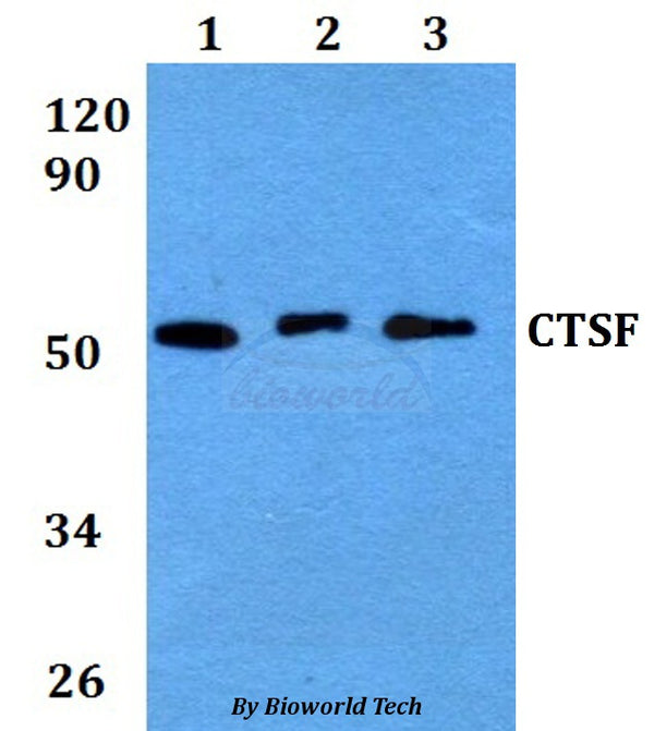 Western blot (WB) analysis of CTSF polyclonal antibody at 1:500 dilution
Lane1:HEK293T whole cell lysate
Lane2:Raw264.7 whole cell lysate 
Lane3:H9C2 whole cell lysate