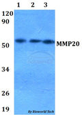 Western blot (WB) analysis of MMP20 polyclonal antibody at 1:500 dilution
Lane1:HEK293T whole cell lysate
Lane2:Raw264.7 whole cell lysate 
Lane3:PC12 whole cell lysate