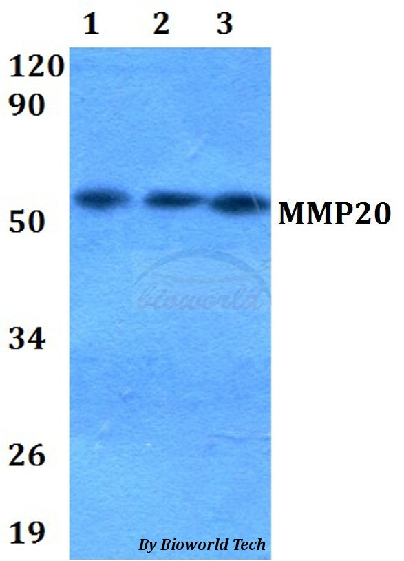 Western blot (WB) analysis of MMP20 polyclonal antibody at 1:500 dilution
Lane1:HEK293T whole cell lysate
Lane2:Raw264.7 whole cell lysate 
Lane3:PC12 whole cell lysate