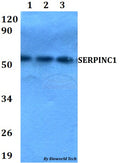 Western blot (WB) analysis of SERPINC1 polyclonal antibody at 1:500 dilution
Lane1:HEK293T whole cell lysate
Lane2:Raw264.7 whole cell lysate 
Lane3:PC12 whole cell lysate