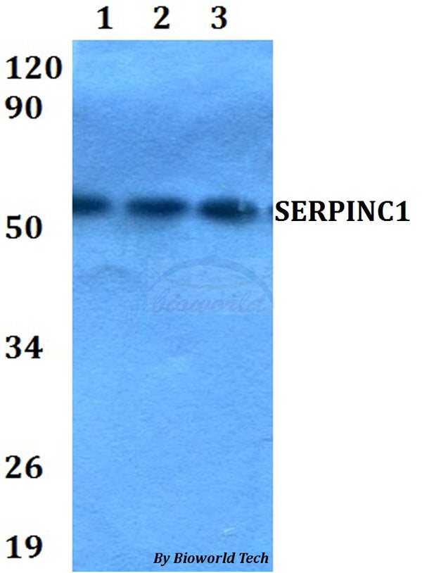 Western blot (WB) analysis of SERPINC1 polyclonal antibody at 1:500 dilution
Lane1:HEK293T whole cell lysate
Lane2:Raw264.7 whole cell lysate 
Lane3:PC12 whole cell lysate