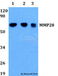 Western blot (WB) analysis of MMP28 polyclonal antibody at 1:500 dilution
Lane1:HEK293T whole cell lysate
Lane2:Raw264.7 whole cell lysate 
Lane3:PC12 whole cell lysate