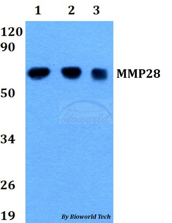 Western blot (WB) analysis of MMP28 polyclonal antibody at 1:500 dilution
Lane1:HEK293T whole cell lysate
Lane2:Raw264.7 whole cell lysate 
Lane3:PC12 whole cell lysate