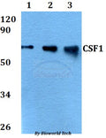 Western blot (WB) analysis of CSF1 polyclonal antibody at 1:500 dilution
Lane1:A549 whole cell lysate
Lane2:sp2/0 whole cell lysate 
Lane3:PC12 whole cell lysate