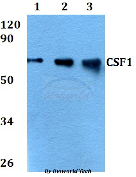 Western blot (WB) analysis of CSF1 polyclonal antibody at 1:500 dilution
Lane1:A549 whole cell lysate
Lane2:sp2/0 whole cell lysate 
Lane3:PC12 whole cell lysate
