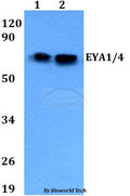 Western blot (WB) analysis of EYA1/4 polyclonal antibody at 1:500 dilution
Lane1:A549 whole cell lysate
Lane2:H9C2 whole cell lysate