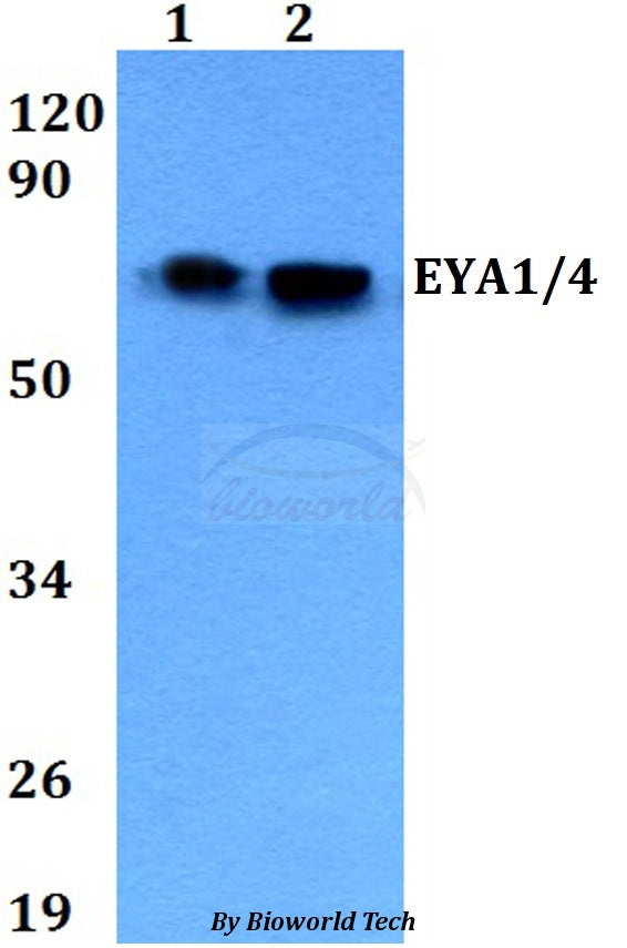 Western blot (WB) analysis of EYA1/4 polyclonal antibody at 1:500 dilution
Lane1:A549 whole cell lysate
Lane2:H9C2 whole cell lysate