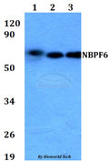 Western blot (WB) analysis of NBPF6 polyclonal antibody at 1:500 dilution
Lane1:HEK293T whole cell lysate
Lane2:Raw264.7 whole cell lysate 
Lane3:H9C2 whole cell lysate
