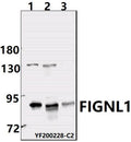 Western blot (WB) analysis of FIGNL1  pAb at 1:1000 dilution
Lane1:PC3  whole cell lysate(40ug)
Lane2:A2780 whole cell lysate(40ug)
Lane3:U-87MG whole cell lysate(40ug)