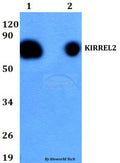 Western blot (WB) analysis of KIRREL2 polyclonal antibody at 1:500 dilution
Lane1:HEK293T whole cell lysate
Lane2:H9C2 whole cell lysate