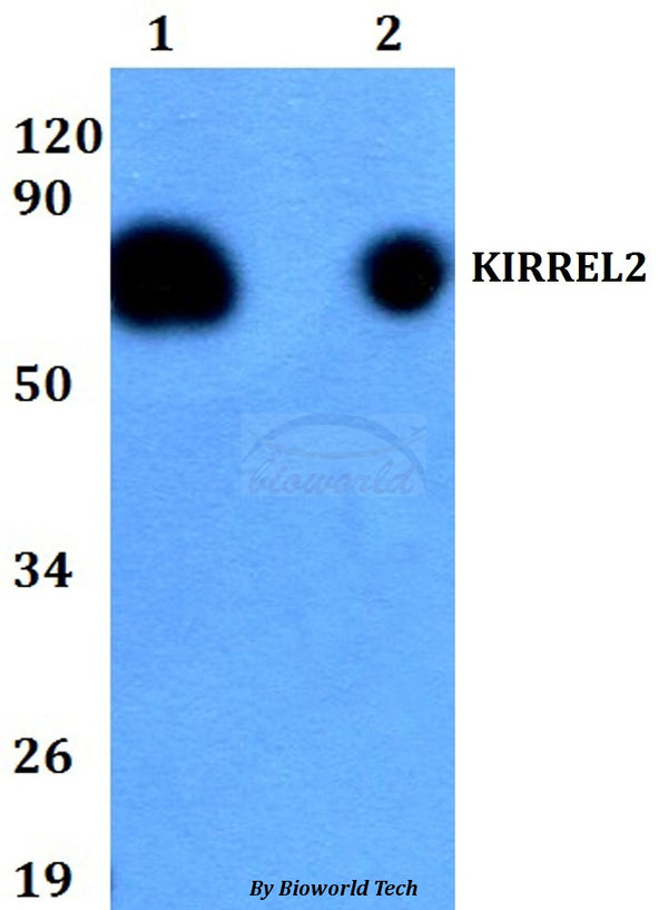 Western blot (WB) analysis of KIRREL2 polyclonal antibody at 1:500 dilution
Lane1:HEK293T whole cell lysate
Lane2:H9C2 whole cell lysate