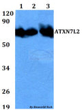 Western blot (WB) analysis of ATXN7L2 polyclonal antibody at 1:500 dilution
Lane1:HEK293T whole cell lysate
Lane2:Raw264.7 whole cell lysate 
Lane3:H9C2 whole cell lysate