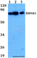 Western blot (WB) analysis of ZNF441 polyclonal antibody at 1:500 dilution
Lane1:HEK293T whole cell lysate
Lane2:A549 whole cell lysate 
Lane3:PC12 whole cell lysate